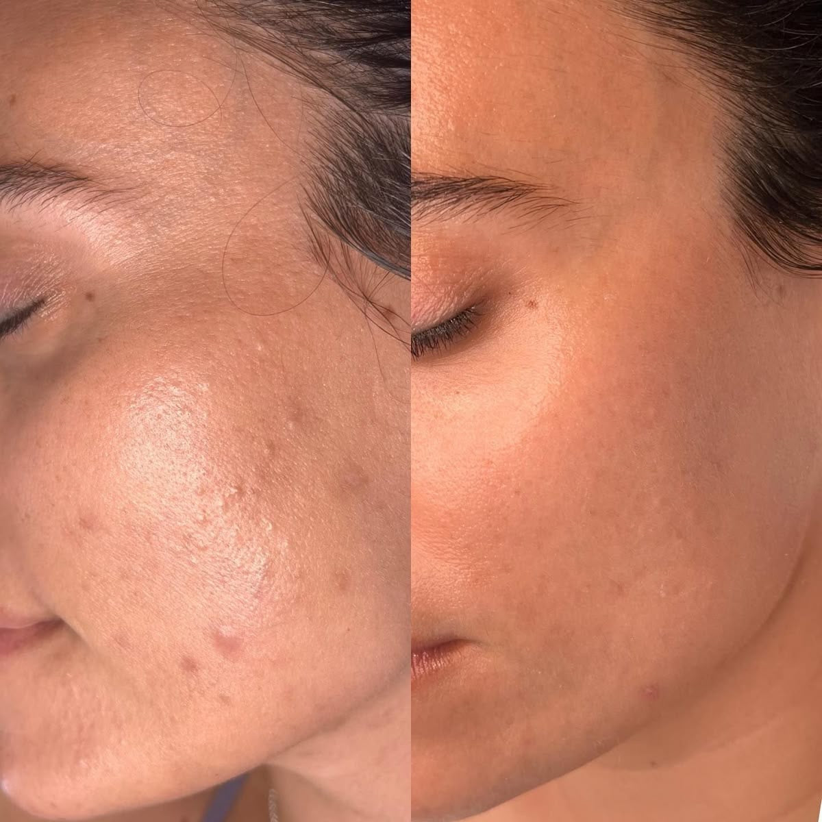 Revitalize Your Skin, Transform Your Confidence